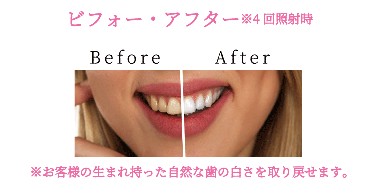 ビフォーアフター画像